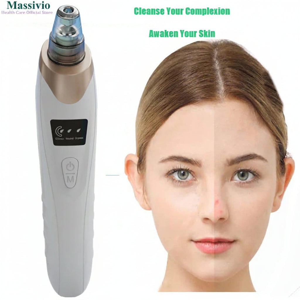 Massivio Remover Vacuum Pore Cleaner Multi Suction Heads Adjustable Suction USB Rechargeable Deep Cleansing Skin Tool Gifts