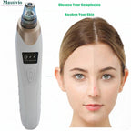 Massivio Remover Vacuum Pore Cleaner Multi Suction Heads Adjustable Suction USB Rechargeable Deep Cleansing Skin Tool Gifts